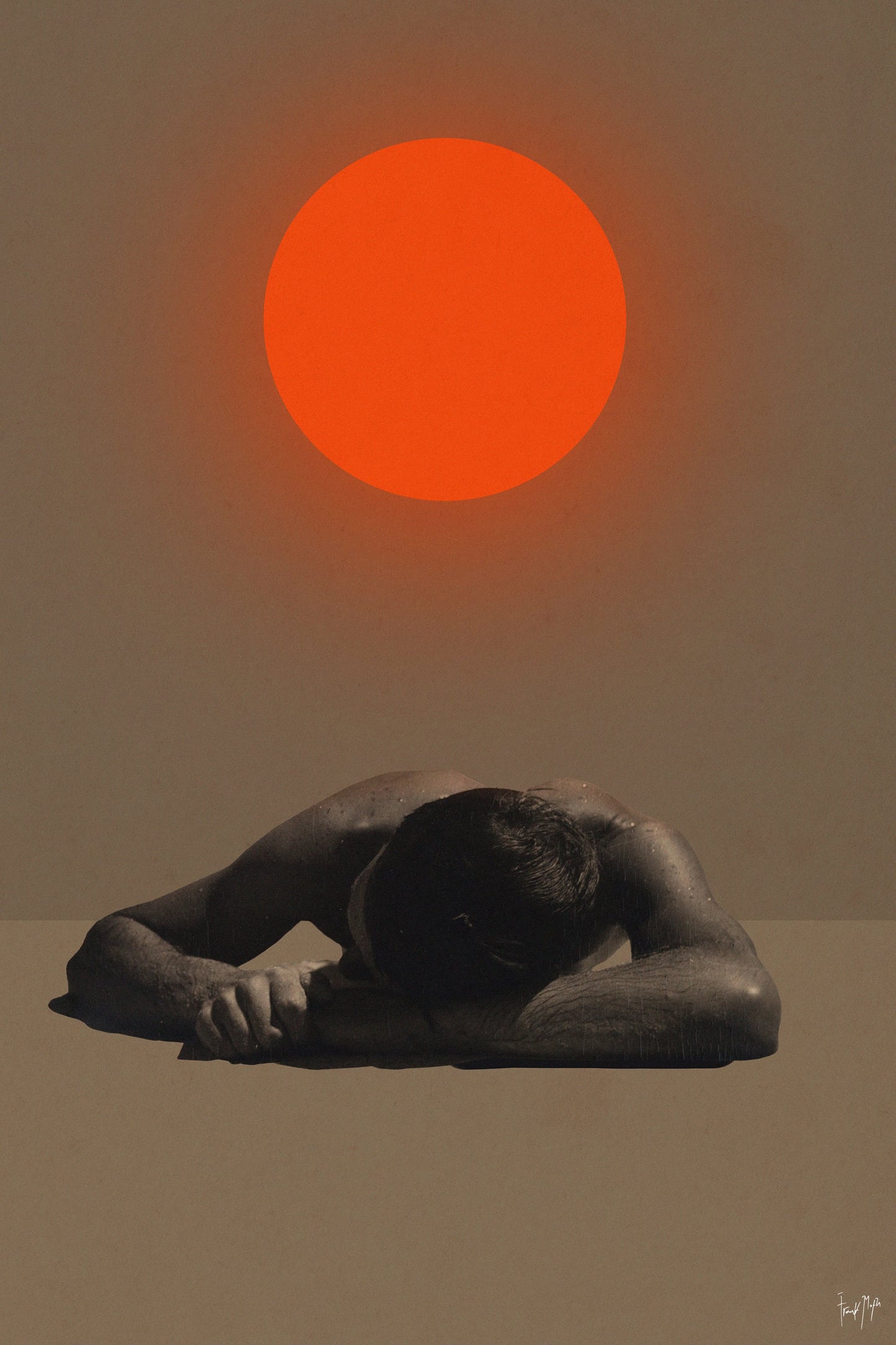 Sunburn