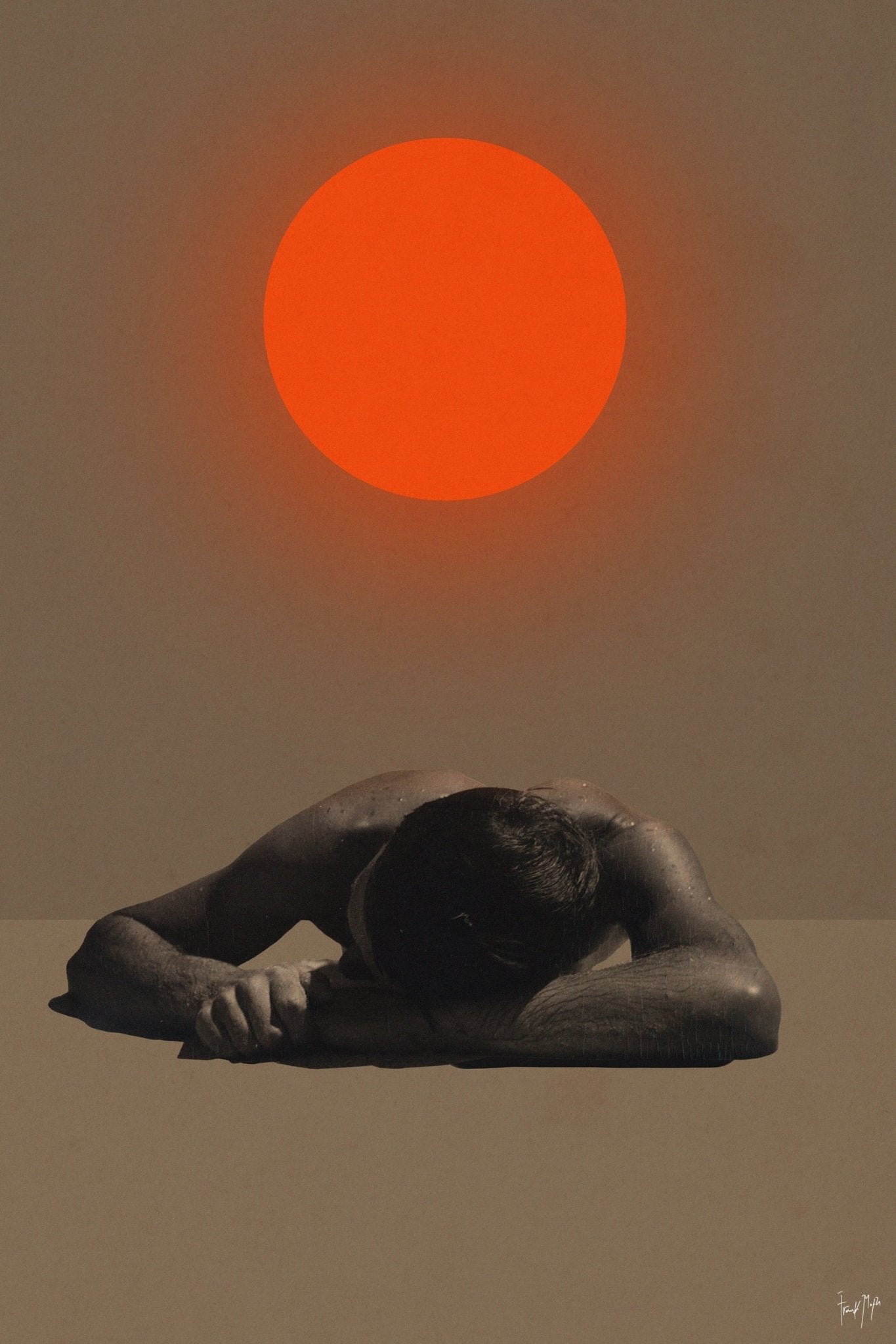 Sunburn