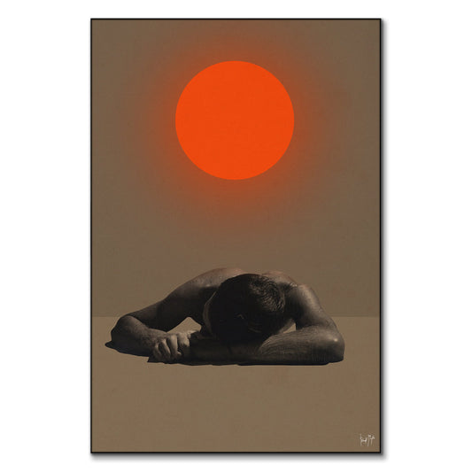 Sunburn