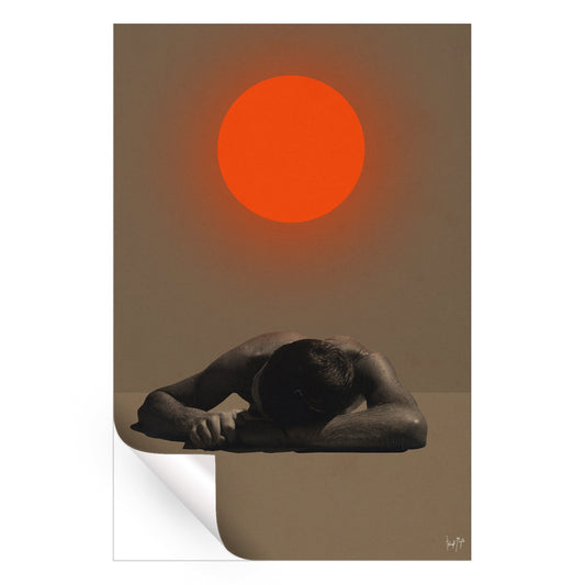 Sunburn
