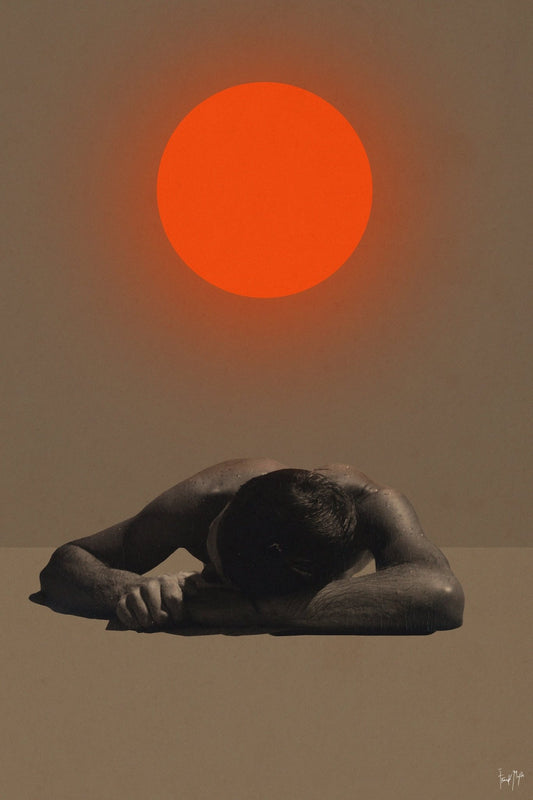 Sunburn
